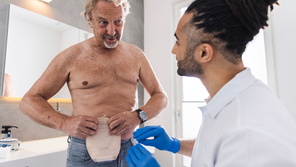 Man with stoma bag on naked upper body with male nurse with gloves indicating him how to apply the bag