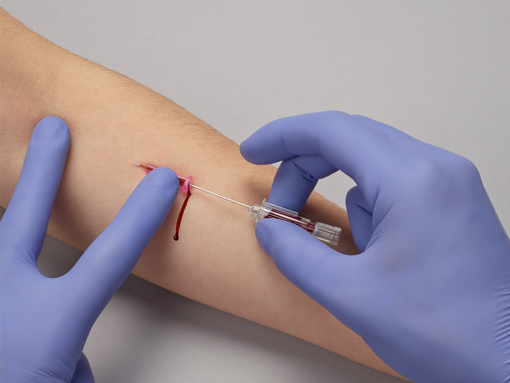 The hands of a healthcare professional, wearing blue gloves, are carefully taking blood from the patient’s arm using a syringe